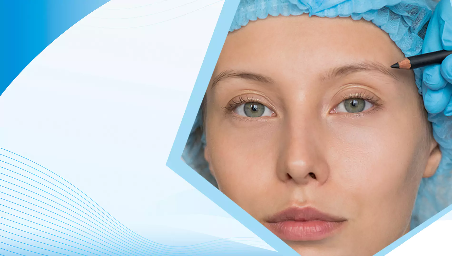 Kaş Kaldırma Ameliyatı