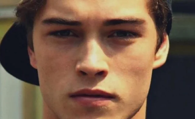 hunter eyes ameliyatı